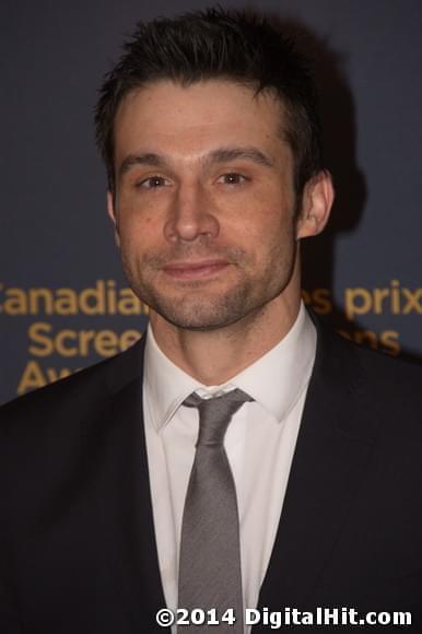 Dillon Casey | CBC Broadcast Gala | 2nd Canadian Screen Awards